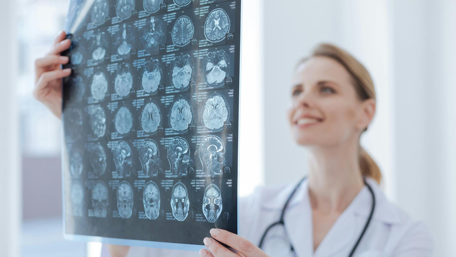 Doctor looking at brain images